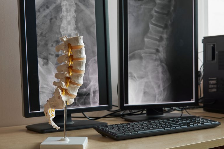 The Most Common Types of  Spine Surgery